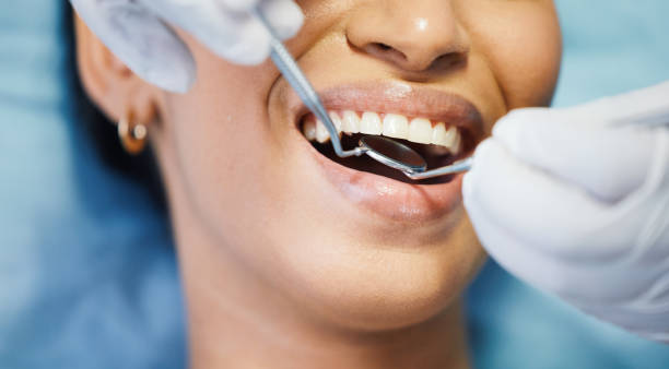 Best Emergency Treatment for Dental Infections or Abscesses in West Columbia, TX