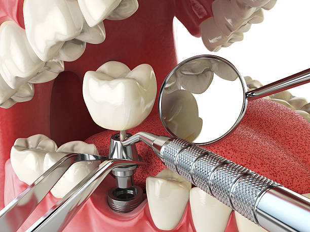 Best Same-Day Emergency Dental Services in West Columbia, TX