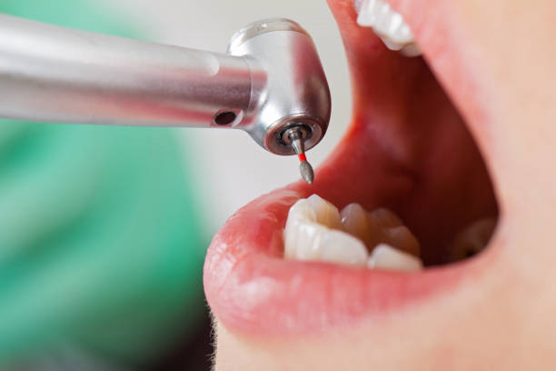 Best Weekend Emergency Dentist in West Columbia, TX